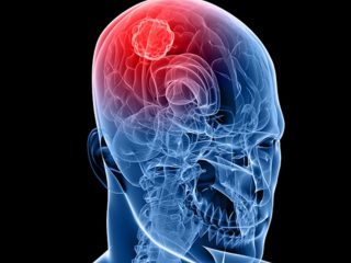 NEURO NEURO